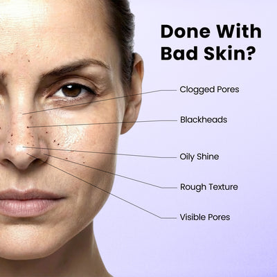 GlowPatch™ Pore Clearing Nose Patch